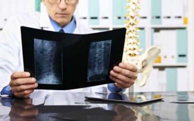 Spinal Compression Fractures: Is My Back Pain a Symptom?